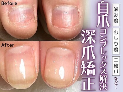 ヴァーチュ(Virtue)の写真