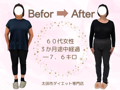 ビジョイ(VIJOY)の写真