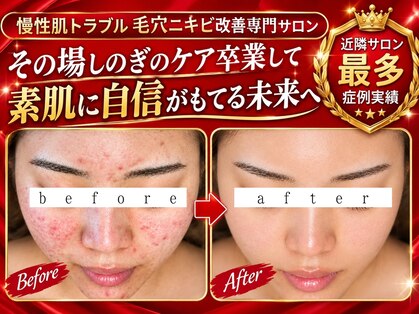 ユウビジン(YOU美人)の写真