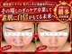 ユウビジン(YOU美人)の写真