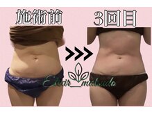 エリクシア 松戸/30代痩身くびれ集中