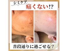 ココ(KOKO)/施術後はメイクして帰宅できます