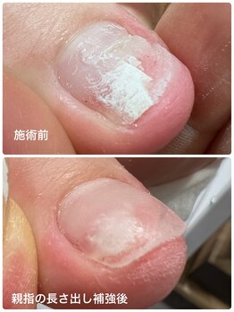 モストネイル 五日市店(MOST nail)/爪のトラブルもお答えします