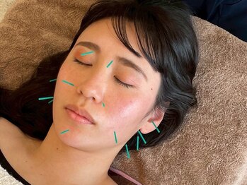 ボディコンシェル(Body Conciel)の写真/リラックスし綺麗を叶える♪初回限定【美顔鍼灸フルコース】10780円→5478円◎予防ケア始めませんか?