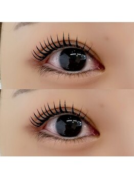 ビースタイル(B-style)/【リフト】リフト