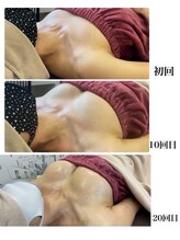 ロココ 豊田店(Rococo)/ビフォーアフター