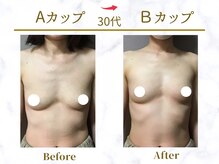 Ms.やまとなでしこ/ビフォーアフター