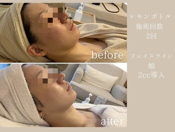 ココロミ(cocoromi)/レモンボトル