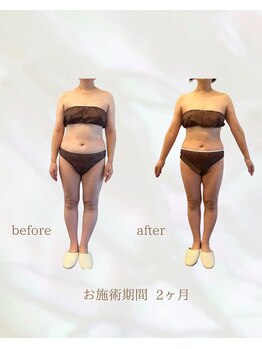 カリス(charis)/二ヶ月の変化☆