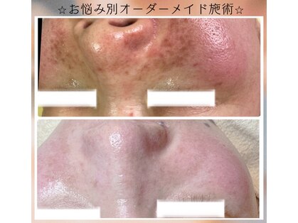 プリエ(Prier)の写真