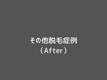 オアシスラグーン(OASIS LAGOON)/その他脱毛