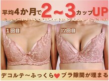 バストサロン メルベイユ(Merveile)
