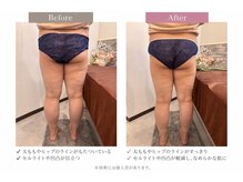 ビューティフルミー(Beautiful Me)の雰囲気（痩せたい部分を集中施術/二の腕・はみ肉/全身施術◎/美肌脱毛◎）