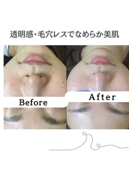 リノ(Lino)/特別な予定の前にもオススメ