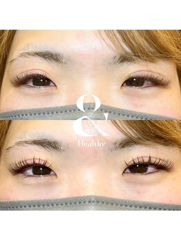 シュウア(SyuA)/&healthyで目元最強☆