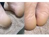 ★フットネイル★つるつる角質ケア4500→3900