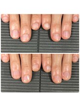 ウェルズユキ(well's yuki)/ピンクの部分を伸ばしたい