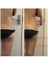 トータルビューティサロン エクスト(EXT)/ラフォス☆全身ボディ