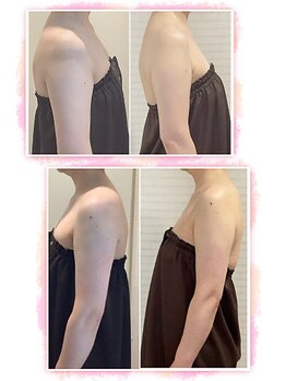 カブール 町田/ほっそり二の腕へ◎