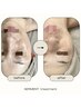 【年齢肌に◎韓国発最先端肌質改善】セルマントリートメント¥22000→¥13400