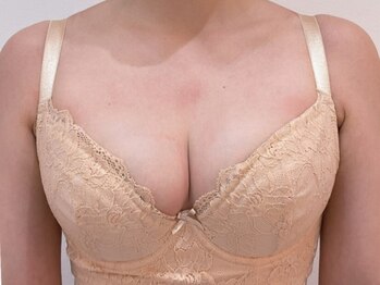 トゥエベル(Tu es belle)/*シンデレラバストアップ*