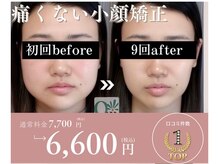 キュープ 名張店(Qpu)