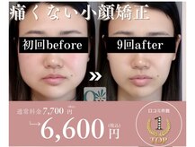 キュープ 名張店(Qpu)