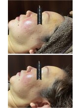 サロン フェリシア(salon Felicia)/50代女性Before/After