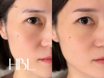 ダイム 仙台店(DIME)/HBL眉癖改善