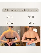 きぃ オリジンプラス(きぃ origin+)/ブライダルbefore after