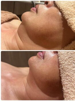 ラピスラズリ/水光レモンボトル結果【3回】