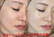 エムラボ 銀座店(M LABO)