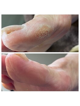 爪屋べっぴん堂/