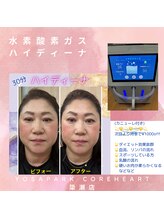 ヨサ パーク コアハート(YOSA PARK CORE HEART)/