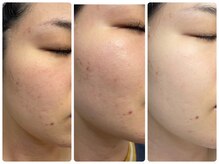エル(ELLE)の雰囲気（◆エニシーグローパック）