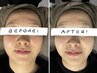 【フェイシャル クイッククーポン】３０分で爆速チェンジ☆ 推し方に最適☆