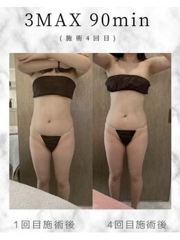 ラズリ(Lazuli)/3MAX90分