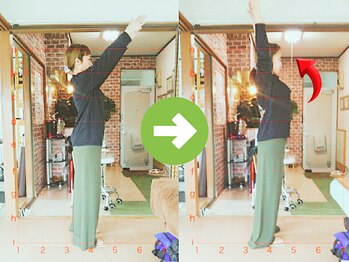 サプライズ整体院/30代ママさんの肩こり初回結果