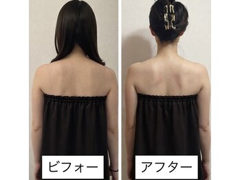 ヴィクトリアサロン(VICTORIA SALON)の写真/身体の不調を見極め、根本改善◎ここでしかない叶わない“オーダーメイド施術”見た目も体感も激変します!