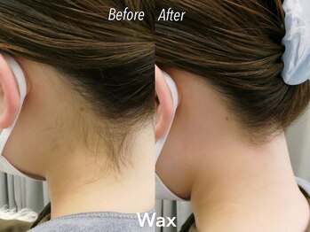 アイロンボーイ(IRONBOY)/うなじ＋首筋WAX ｜脱毛ワックス
