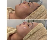 ジェニー(JENNI)の雰囲気(速攻性小顔矯正)
