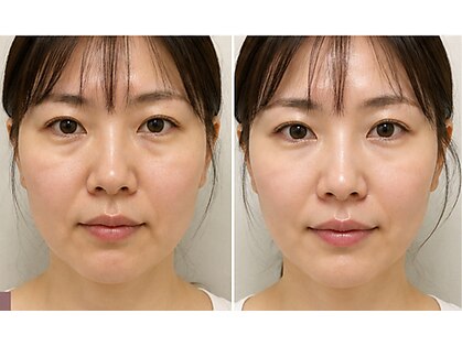 コンビンス(convince)の写真