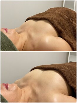 サロン ド アヴニール(SALON de AVENIR)/バスト形成☆ボリュームUp