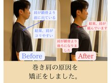 エール(EALL)/巻き肩、猫背の施術
