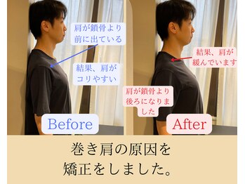 エール(EALL)/巻き肩、猫背の施術