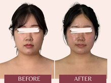 アンリール(Anrire)/【板橋/フェイシャルエステ】