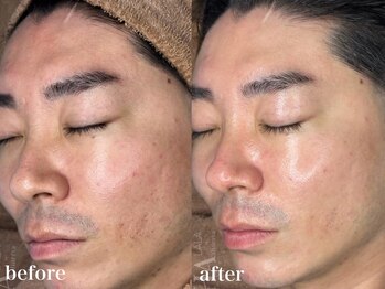 エミレ(EMIRE)の写真/男性も通いやすいサロン。オイルリンパマッサージやフェイシャルを本格施術。疲れや肌悩みをまとめてケア◎