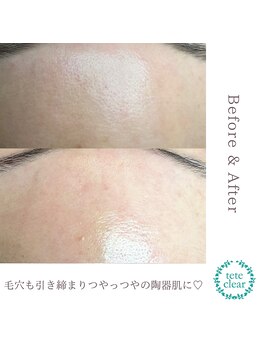 ソマリ(SOMALI)/40代 女性 Before & After