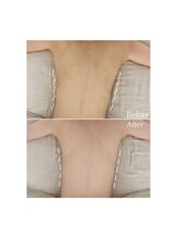 アンバー(Amber)/Before→After