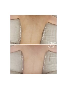 アンバー(Amber)/Before→After